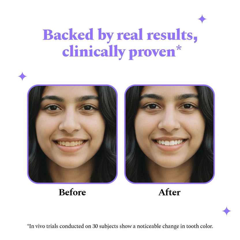 Purple Magic Teeth Whitening Strips - Self Dissolving