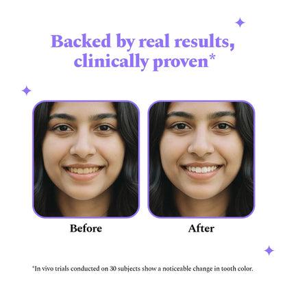 Purple Magic Teeth Whitening Strips - Self Dissolving